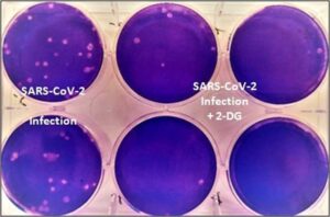 Anti-Covid drug